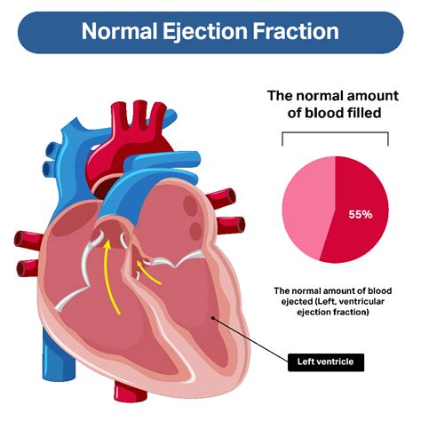 systolic function vs ejection fraction